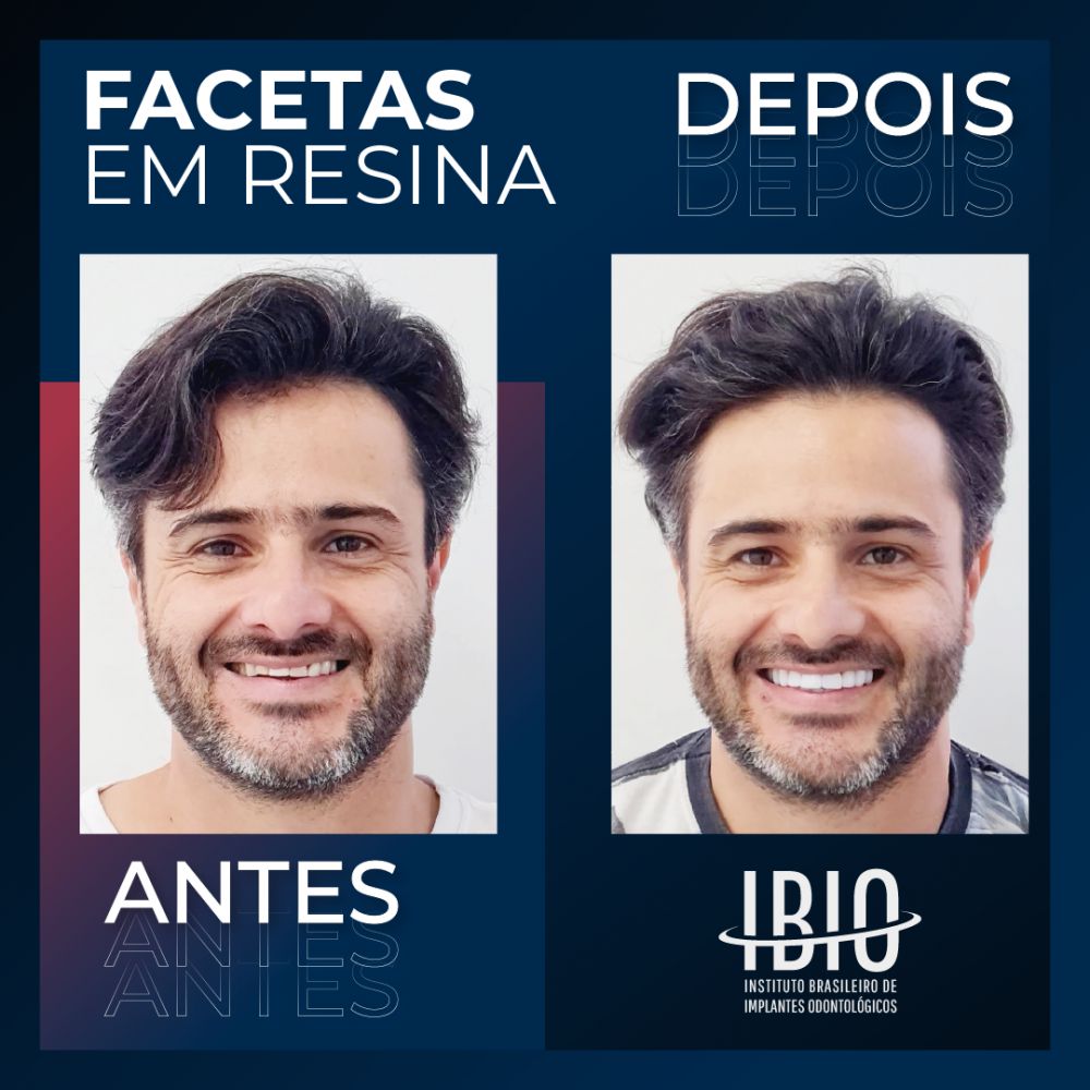 Ibio - instituto brasileiro de implantes odontologicos