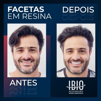 Ibio - instituto brasileiro de implantes odontologicos. Guia de empresas e servios